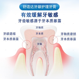 舒适达牙龈护理抗敏感牙膏  缓解牙齿敏感减轻牙龈防蛀180g
