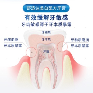 舒适达美白配方抗敏感牙膏  美白护理抗敏亮白牙齿清新口气去渍180g